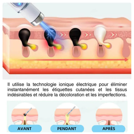 Stylo Laser Anti-Grains de Beauté & Verrues