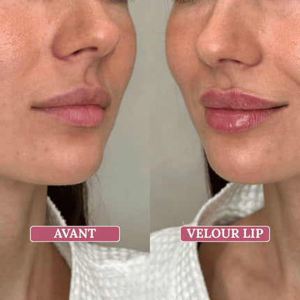 Lip Boost - Repulpant à lèvres